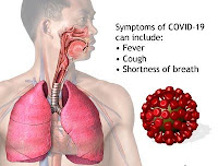 Common Symptoms of COVID-19 Common Symptoms of COVID-19